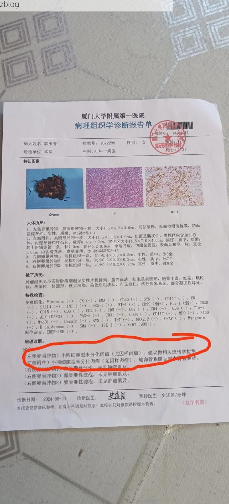 【2022年3月21日厦门新增确诊病例情况_15162】