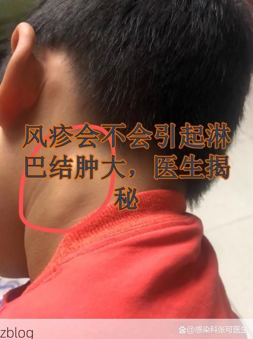 【宁洱哈尼族彝族自治县新增1例无症状感染者  宁洱哈尼族彝族自治县疫情防控最新通报_3773】