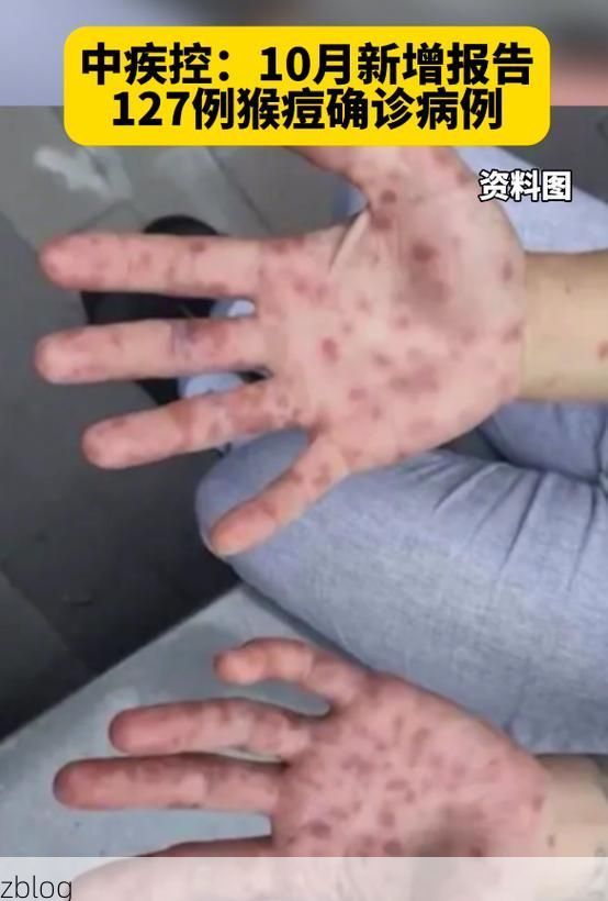 2022年10月26日新野新增确诊病例情况