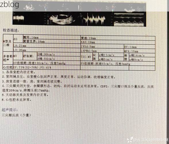 2022年3月15日江川新增确诊病例情况_15857