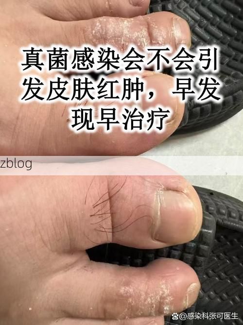 元江哈尼族彝族傣族自治县新增1例无症状感染者  元江哈尼族彝族傣族自治县疫情防控最新通报_65652