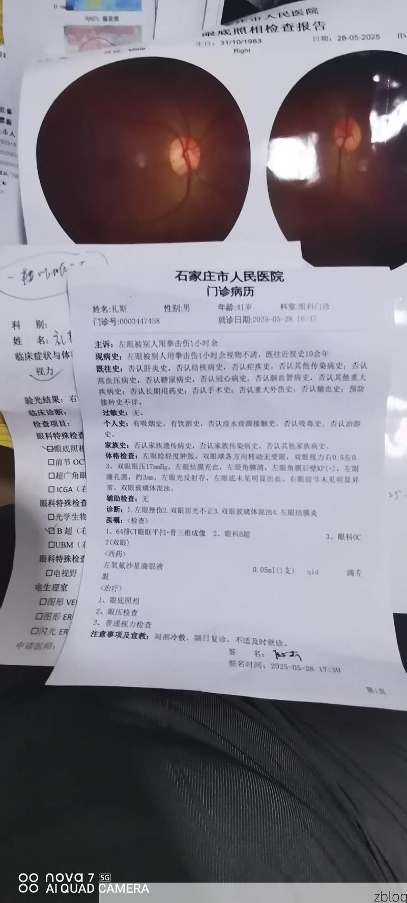 2022年3月15日鹤山区新增确诊病例情况_12565