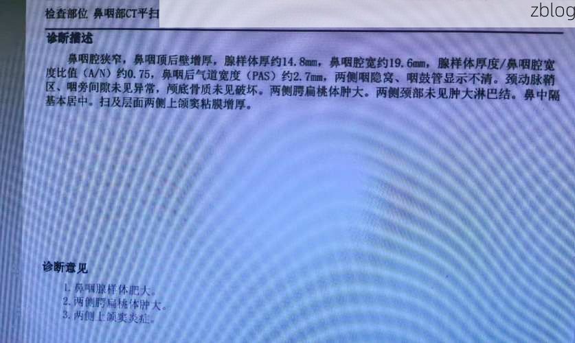 【2022年3月15日临沭新增确诊病例情况_17576】