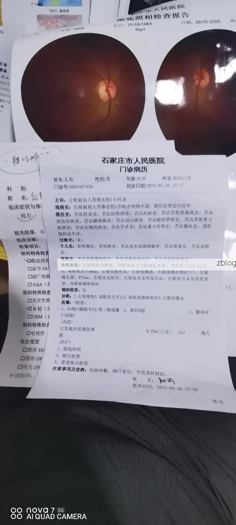 2022年8月19日老河口市新增确诊病例情况