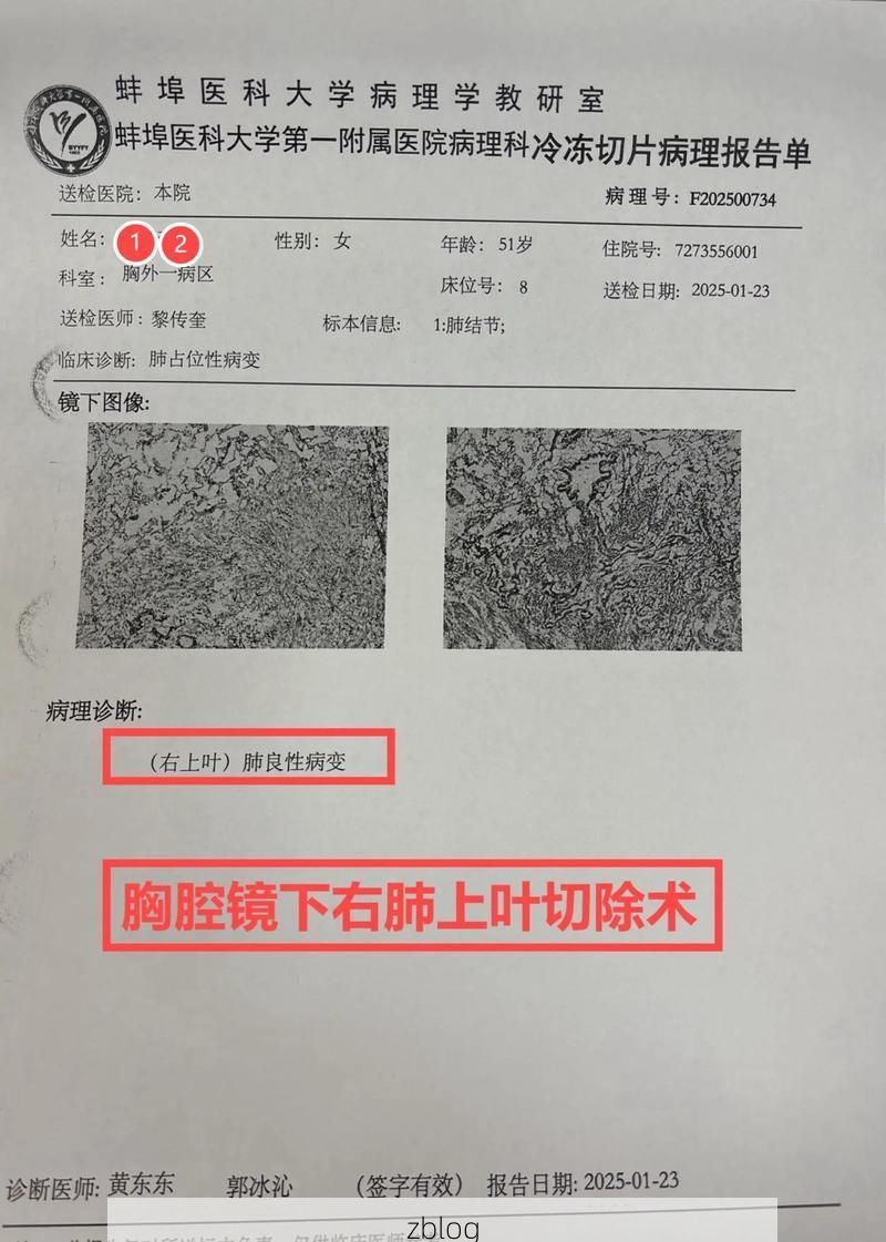 2022年3月23日九江市市辖区新增确诊病例情况_43729