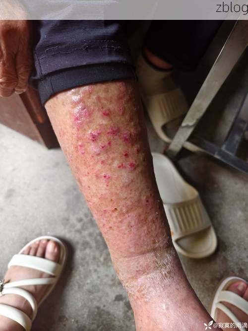 浦北：六万山屏障下的低感染样本