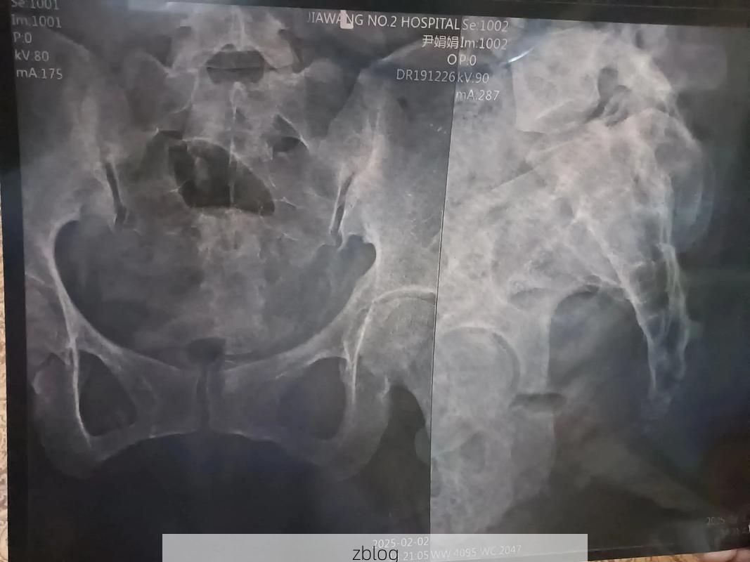 2022年3月25日永新县新增确诊病例情况_41012