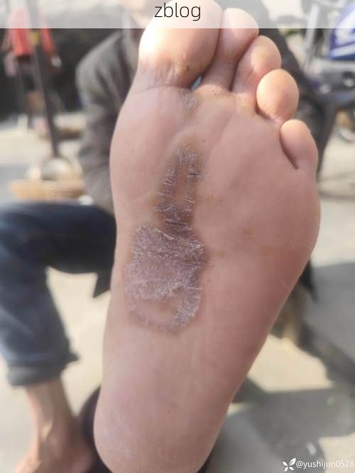 黔西县：高原山地屏障下的低感染样本