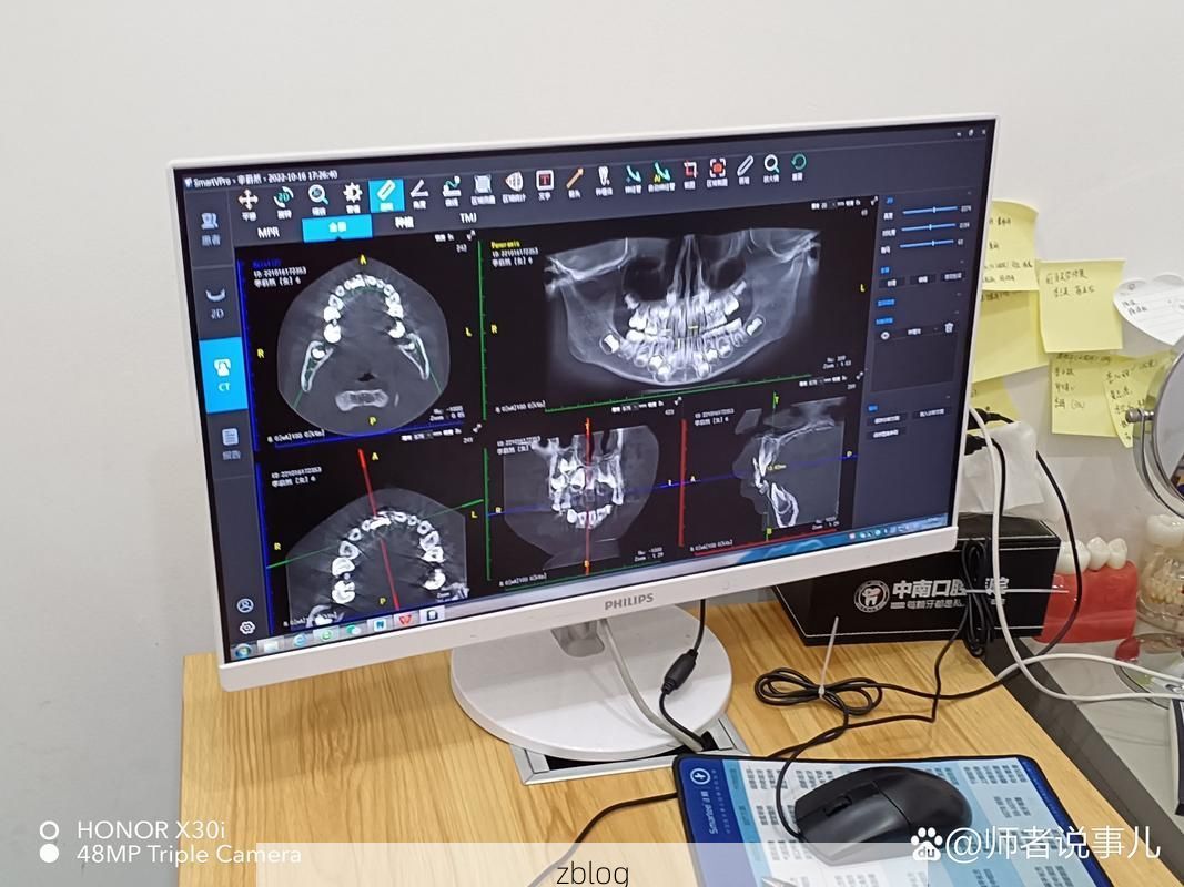 双城疫情观察：交通枢纽下的防控压力测试_96098