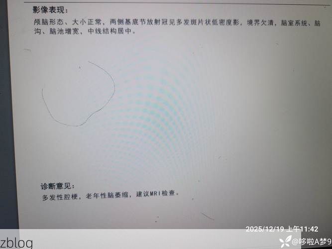 2022年3月8日内蒙古磴口县新增确诊病例情况