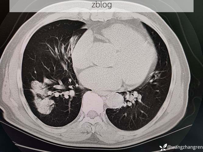 左云县：晋北高原屏障下的低感染样本