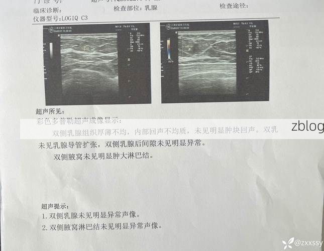 2022年8月15日贡嘎县新增确诊病例情况_47731
