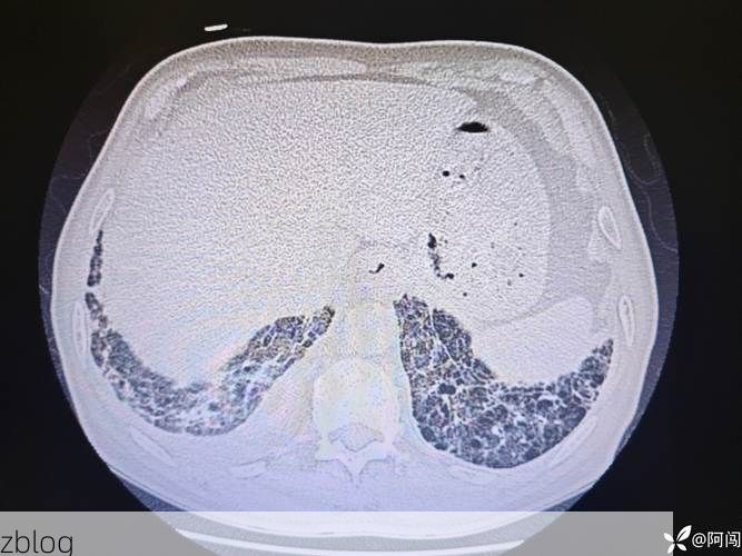 安化：雪峰山屏障下的低感染率样本_28924