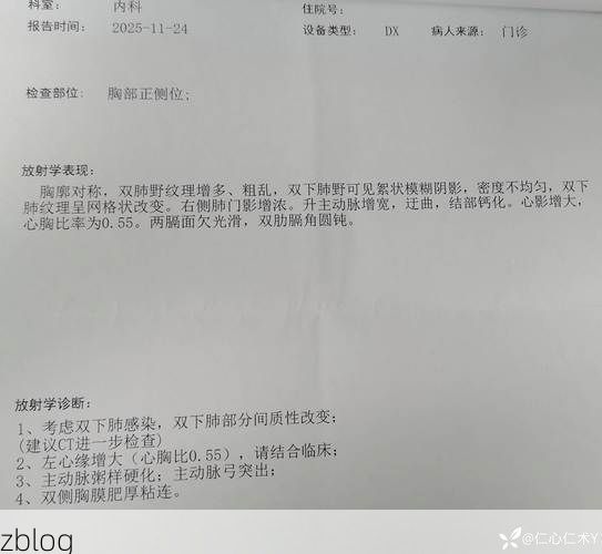 本地确诊+4，南岸区通报新增病例情况_35181