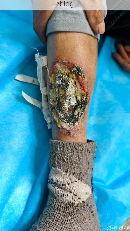 城口：大巴山屏障下的低感染样本_67053