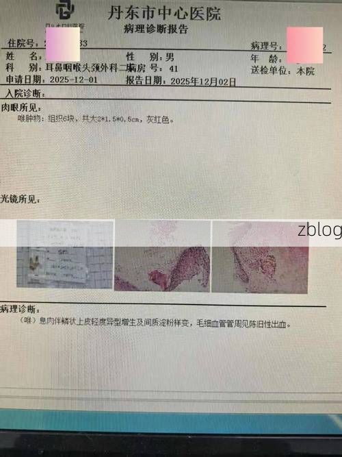 2022年11月25日蓝山县新增确诊病例情况_34956