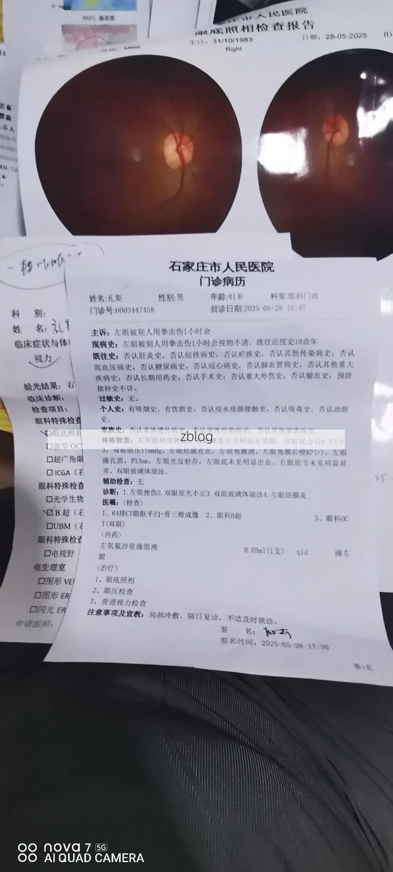 2022年7月5日阜南县新增确诊病例情况_42783