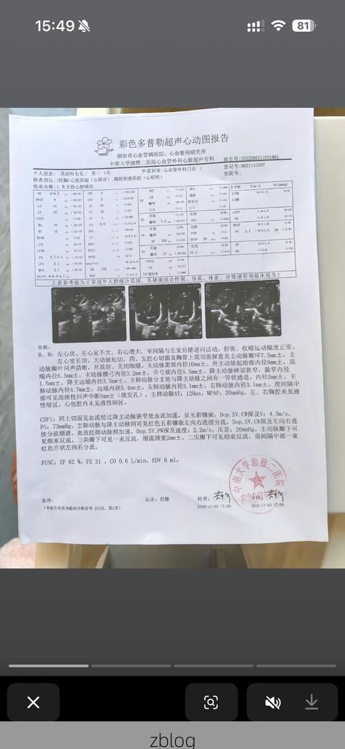 2022年3月23日岳阳新增确诊病例情况_23121