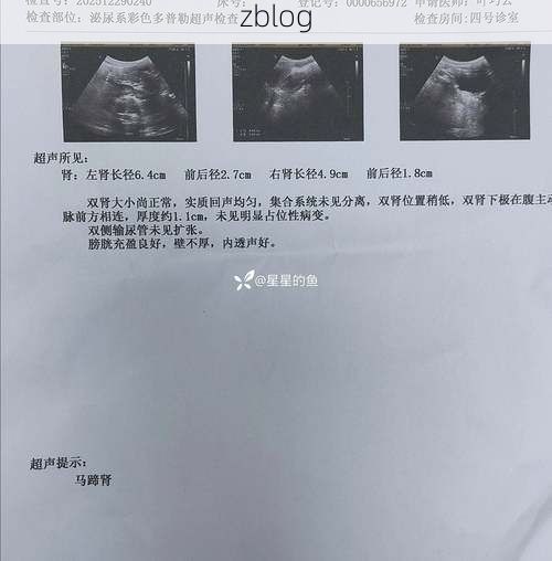 2022年3月15日马村区新增确诊病例情况